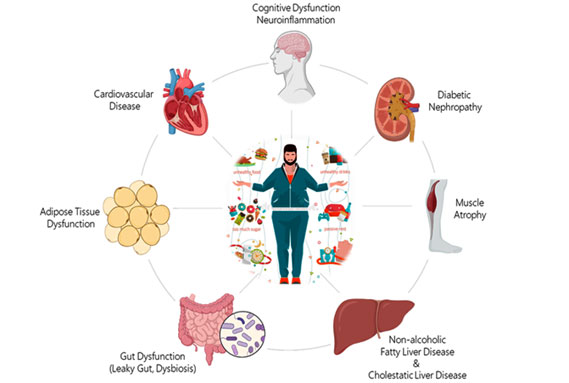 translational model